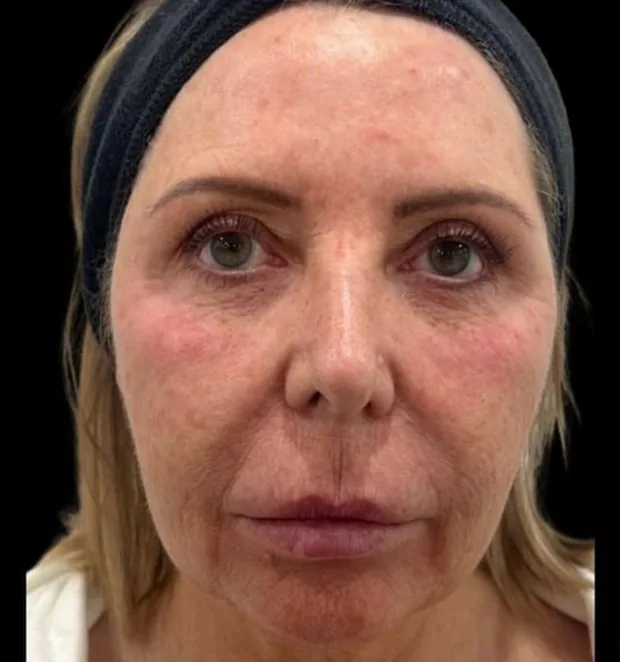 Patient before surgery