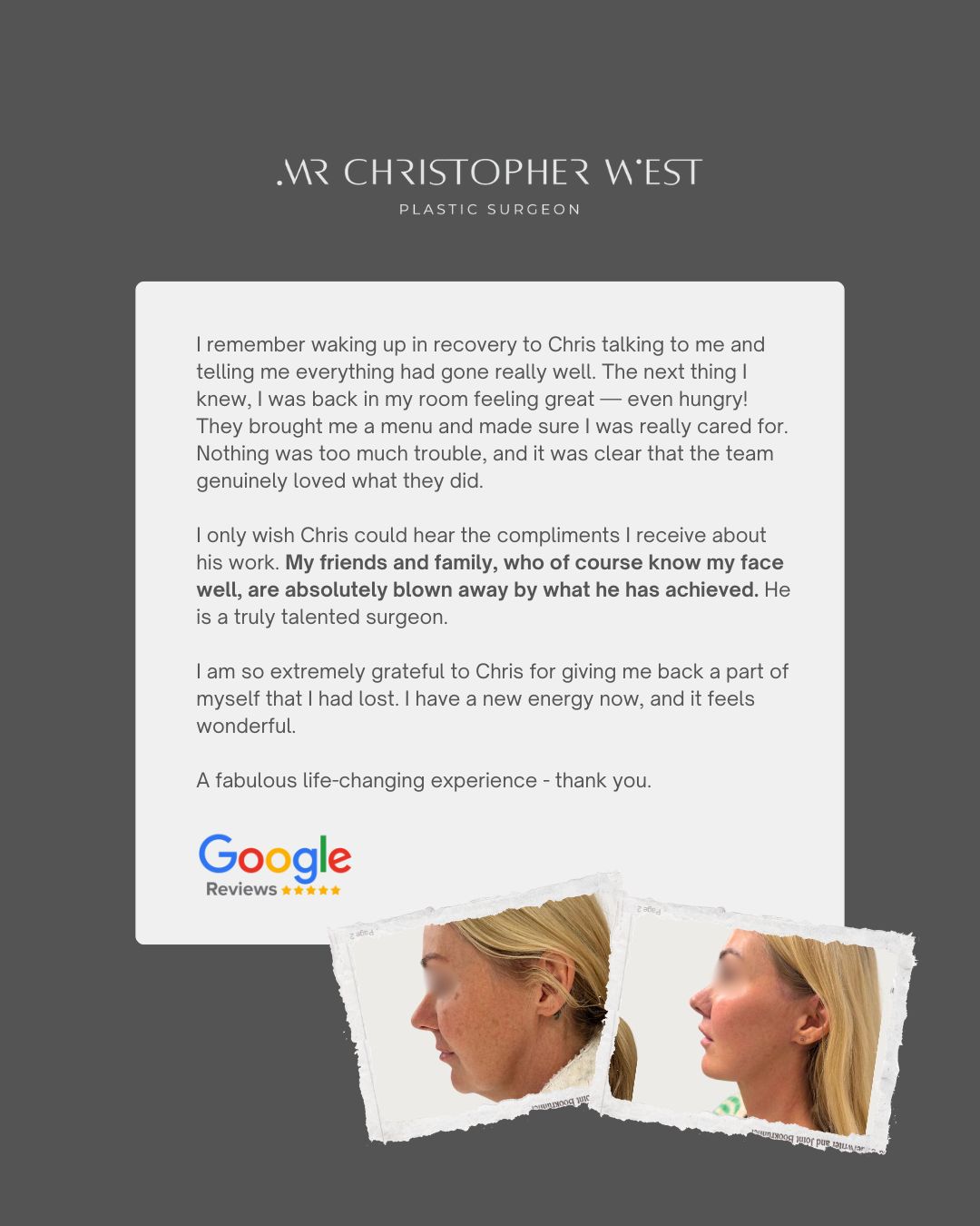 Placeholder for Mr Christopher West patient before and after images showing improvement in neck skin laxity after surgery